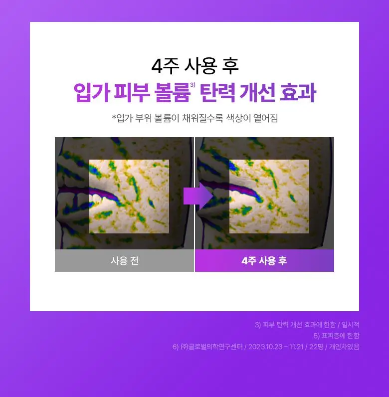 [최다증정|기프트] 바이오힐보 프로바이오덤 3D리프팅 스킨케어 3종세트(토너+에멀전+크림) 상세페이지 19